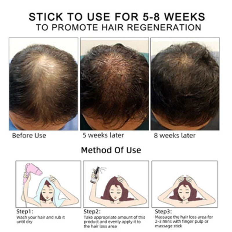 Hair Growth Oil Hair Growth Oil Oem Hair Care