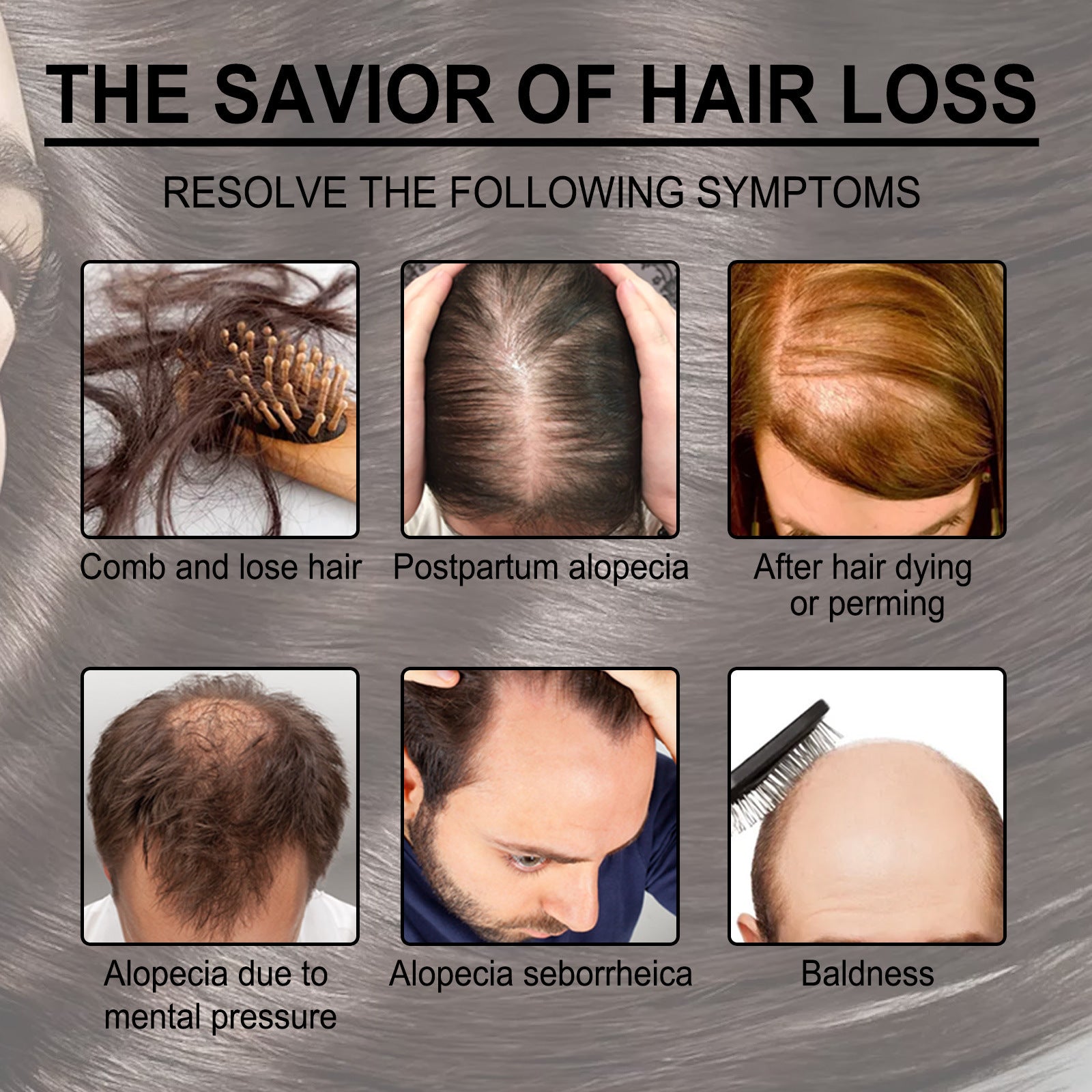 Rosemary Hair Care Essential Oil Anti-loss Hair Growth
