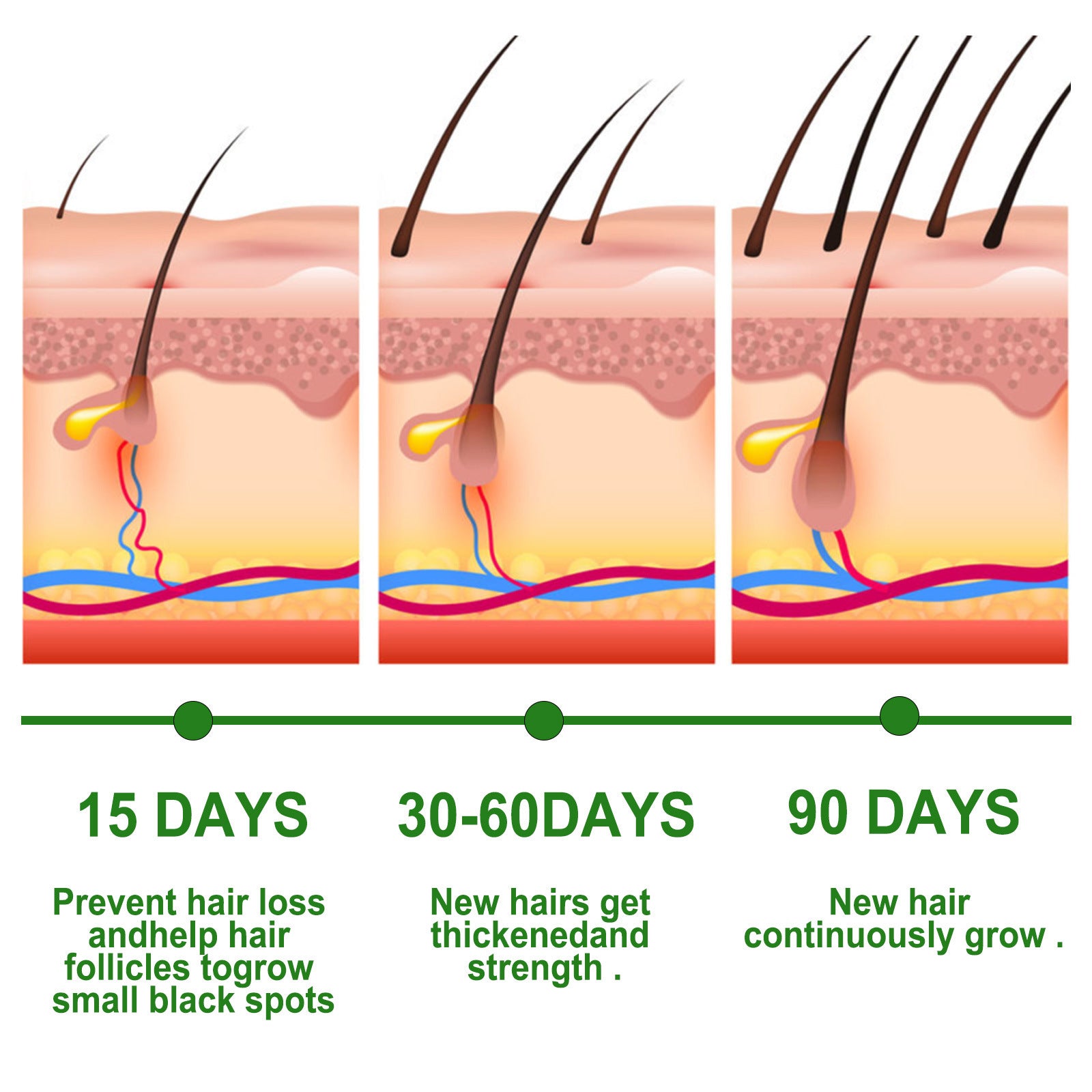 Rosemary Hair Care Essential Oil Anti-loss Hair Growth