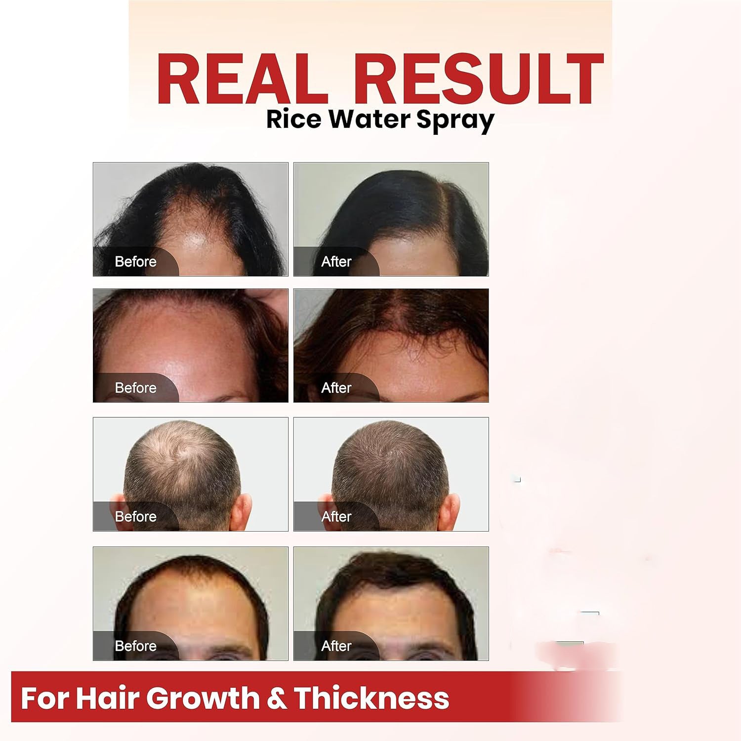 Hair Growth Spray Batana Oil 