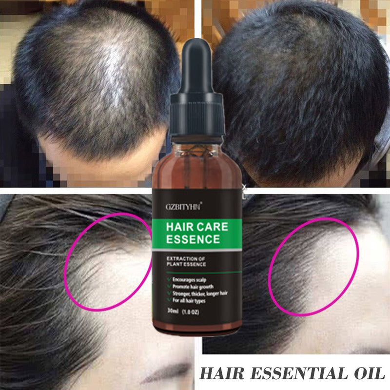 Hair Growth Oil Hair Growth Oil Oem Hair Care