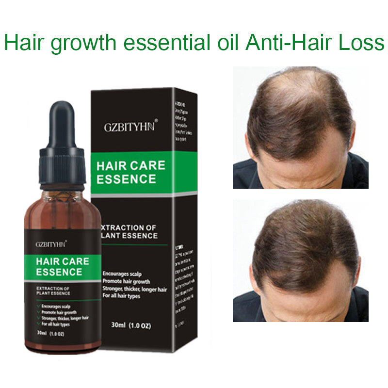 Hair Growth Oil Hair Growth Oil Oem Hair Care