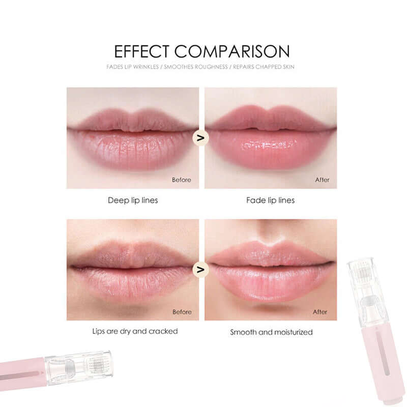3 In 1 Lip Care Roller Needle