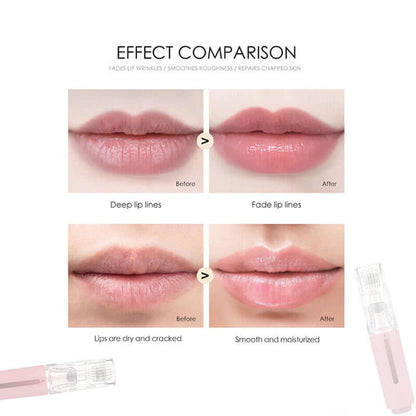 3 In 1 Lip Care Roller Needle