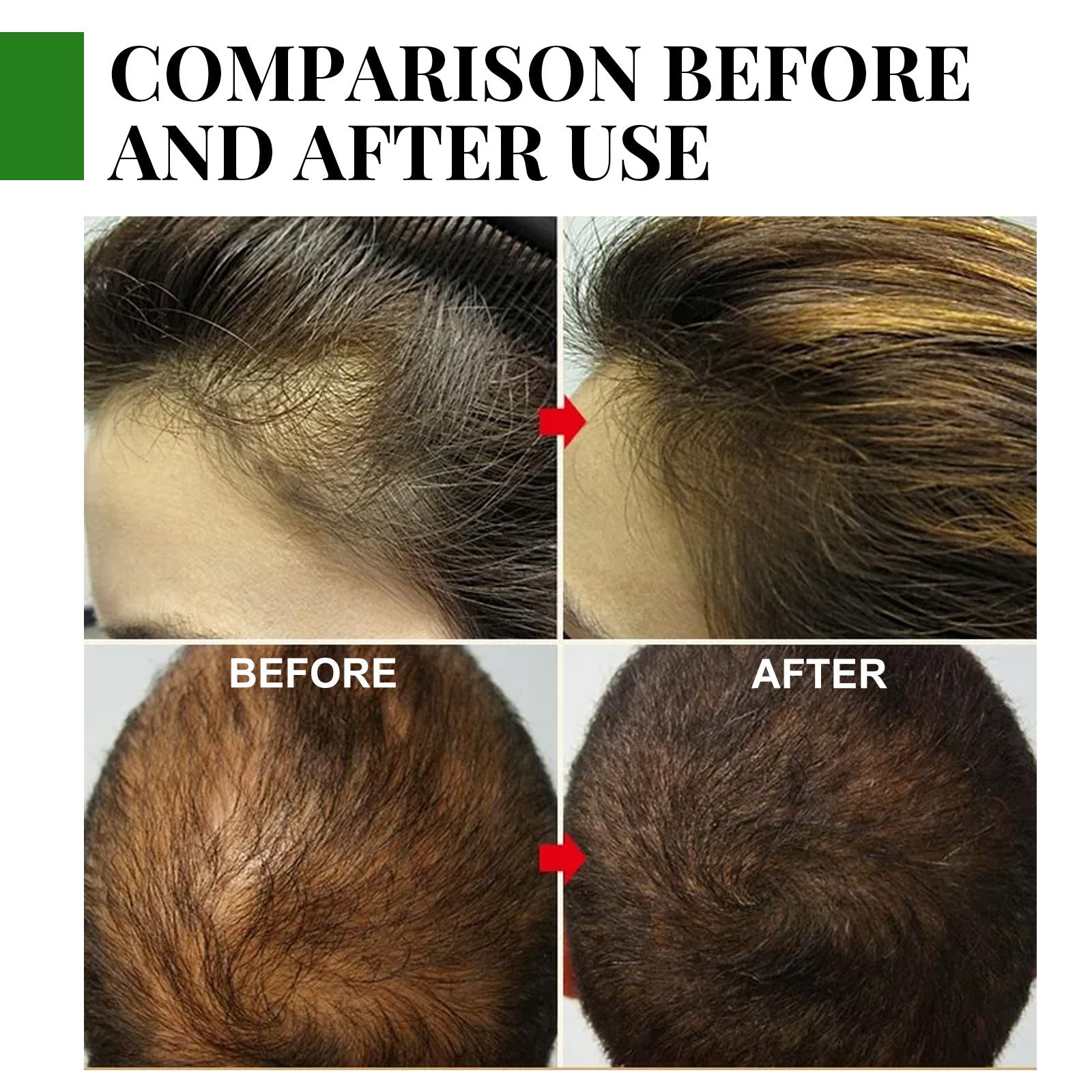 Rosemary Hair Care Essential Oil Anti-loss Hair Growth